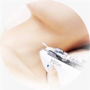 Nanochip  til Ansigt(Krop)